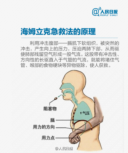 小學(xué)生急救常識